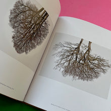 Load image into Gallery viewer, Looking At Trees